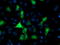 Phosphofructokinase, Platelet antibody, TA503983, Origene, Immunofluorescence image 