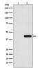 Neuraminidase antibody, M30975-2, Boster Biological Technology, Western Blot image 
