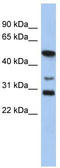 SRY-Box 3 antibody, TA333939, Origene, Western Blot image 