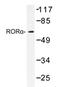 Nuclear receptor ROR-alpha antibody, AP20414PU-N, Origene, Western Blot image 