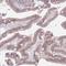 Zinc Finger Protein 576 antibody, NBP2-13584, Novus Biologicals, Immunohistochemistry frozen image 