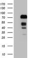 Forkhead Box O4 antibody, LS-C794424, Lifespan Biosciences, Western Blot image 