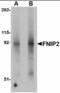 Folliculin-interacting protein 2 antibody, orb89827, Biorbyt, Western Blot image 