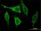 Calsenilin antibody, H00030818-M01, Novus Biologicals, Immunocytochemistry image 