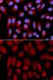 Transporter 2, ATP Binding Cassette Subfamily B Member antibody, GTX16394, GeneTex, Immunofluorescence image 