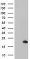 ADP Ribosylation Factor Like GTPase 5B antibody, LS-C173668, Lifespan Biosciences, Western Blot image 