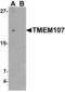 Lon Peptidase 1, Mitochondrial antibody, orb314157, Biorbyt, Western Blot image 
