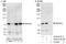 Histone-lysine N-methyltransferase SETMAR antibody, A303-614A, Bethyl Labs, Western Blot image 