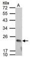Probable DNA dC->dU-editing enzyme APOBEC-3C antibody, GTX102164, GeneTex, Western Blot image 