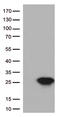 Cancer/Testis Antigen 1B antibody, UM500061CF, Origene, Western Blot image 