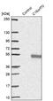 Chromosome 16 Open Reading Frame 70 antibody, NBP1-88453, Novus Biologicals, Western Blot image 