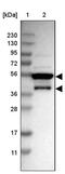 Magnesium Transporter MRS2 antibody, PA5-53616, Invitrogen Antibodies, Western Blot image 