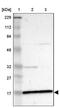 Zinc Finger Protein 226 antibody, PA5-52260, Invitrogen Antibodies, Western Blot image 
