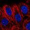 Centromere Protein T antibody, NBP2-34093, Novus Biologicals, Immunofluorescence image 