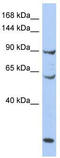 DNA replication licensing factor MCM8 antibody, TA341707, Origene, Western Blot image 