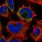 Protein S100-A3 antibody, HPA056140, Atlas Antibodies, Immunofluorescence image 