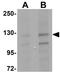 Transmembrane Protein 94 antibody, GTX31393, GeneTex, Western Blot image 