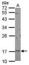Cyclin Dependent Kinase Inhibitor 2D antibody, GTX102414, GeneTex, Western Blot image 