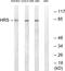 Hepatocyte Growth Factor-Regulated Tyrosine Kinase Substrate antibody, LS-C117954, Lifespan Biosciences, Western Blot image 