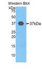 EGF Containing Fibulin Extracellular Matrix Protein 2 antibody, LS-C713371, Lifespan Biosciences, Western Blot image 