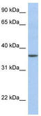 LFNG O-Fucosylpeptide 3-Beta-N-Acetylglucosaminyltransferase antibody, TA335969, Origene, Western Blot image 