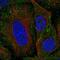 SEM1 26S Proteasome Complex Subunit antibody, NBP2-57559, Novus Biologicals, Immunocytochemistry image 