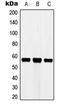 Cytochrome P450 Family 3 Subfamily A Member 7 antibody, LS-C352079, Lifespan Biosciences, Western Blot image 