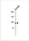 Anoctamin-6 antibody, TA324699, Origene, Western Blot image 