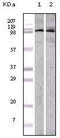 EPH Receptor A1 antibody, M03024, Boster Biological Technology, Western Blot image 