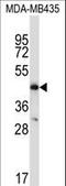 C-C Motif Chemokine Receptor 9 antibody, LS-C168493, Lifespan Biosciences, Western Blot image 