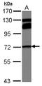 Methylenetetrahydrofolate Reductase antibody, LS-C155174, Lifespan Biosciences, Western Blot image 