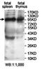 Zinc Finger Protein 33B antibody, orb78202, Biorbyt, Western Blot image 