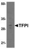 Tissue Factor Pathway Inhibitor antibody, TA326640, Origene, Western Blot image 