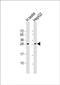 Lin-28 Homolog B antibody, PA5-71920, Invitrogen Antibodies, Western Blot image 