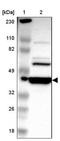 RIB43A Domain With Coiled-Coils 2 antibody, NBP1-86814, Novus Biologicals, Western Blot image 