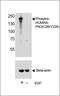 Phosphatidylinositol-4-Phosphate 3-Kinase Catalytic Subunit Type 2 Beta antibody, PA5-72388, Invitrogen Antibodies, Western Blot image 