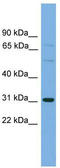 Solute Carrier Organic Anion Transporter Family Member 1B1 antibody, TA333919, Origene, Western Blot image 