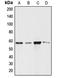 Angiopoietin Like 1 antibody, LS-C353118, Lifespan Biosciences, Western Blot image 