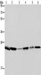 Rho GDP-dissociation inhibitor 1 antibody, TA350013, Origene, Western Blot image 