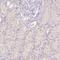 Mannose Receptor C-Type 1 antibody, HPA045134, Atlas Antibodies, Immunohistochemistry paraffin image 