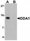 DET1 And DDB1 Associated 1 antibody, TA320007, Origene, Western Blot image 