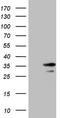 Small Nuclear Ribonucleoprotein Polypeptide B2 antibody, TA808141, Origene, Western Blot image 
