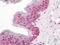 C4d antibody, orb223660, Biorbyt, Immunohistochemistry paraffin image 