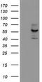 Cyp17 antibody, TA503442S, Origene, Western Blot image 