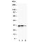 CUE Domain Containing 2 antibody, R31066, NSJ Bioreagents, Western Blot image 