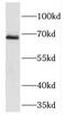 Forkhead Box D4 antibody, FNab03192, FineTest, Western Blot image 