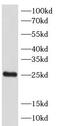 Sperm surface protein Sp17 antibody, FNab08136, FineTest, Western Blot image 