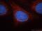 Myocardial Zonula Adherens Protein antibody, 18129-1-AP, Proteintech Group, Immunofluorescence image 