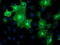 Metabolism Of Cobalamin Associated B antibody, TA502265, Origene, Immunofluorescence image 