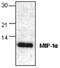 C-C Motif Chemokine Ligand 3 antibody, GTX59845, GeneTex, Western Blot image 